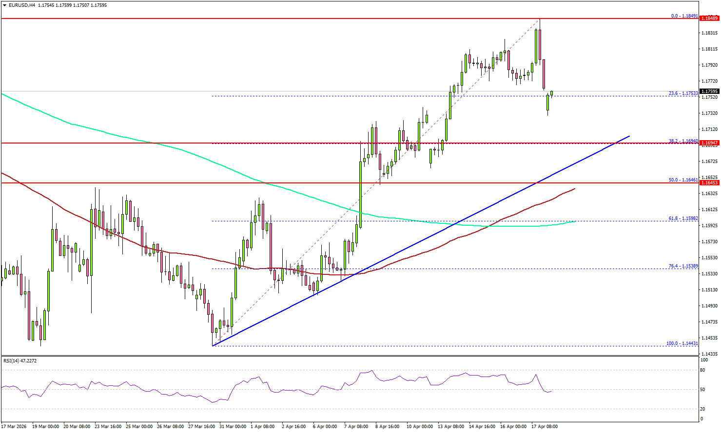 EUR/USD Dips Draw Interest, Bulls Prepare to Step In
