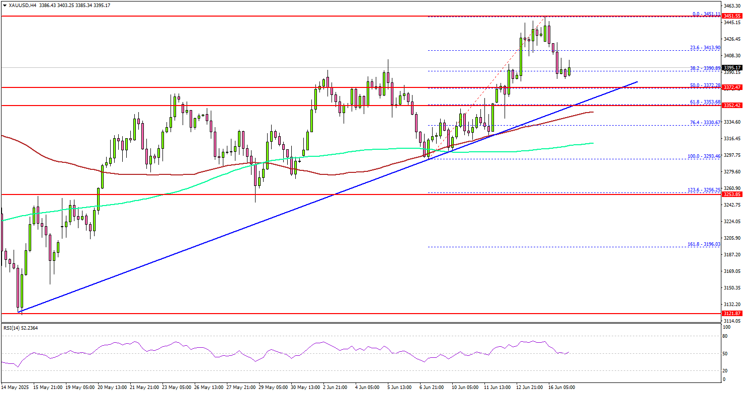 Gold Dips, But Sentiment Turns Bullish on Long-Term Potential