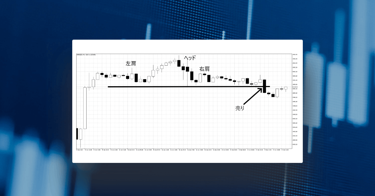 ヘッドアンドショルダーズパターンを解き明かす： テクニカル分析における強力なツール
